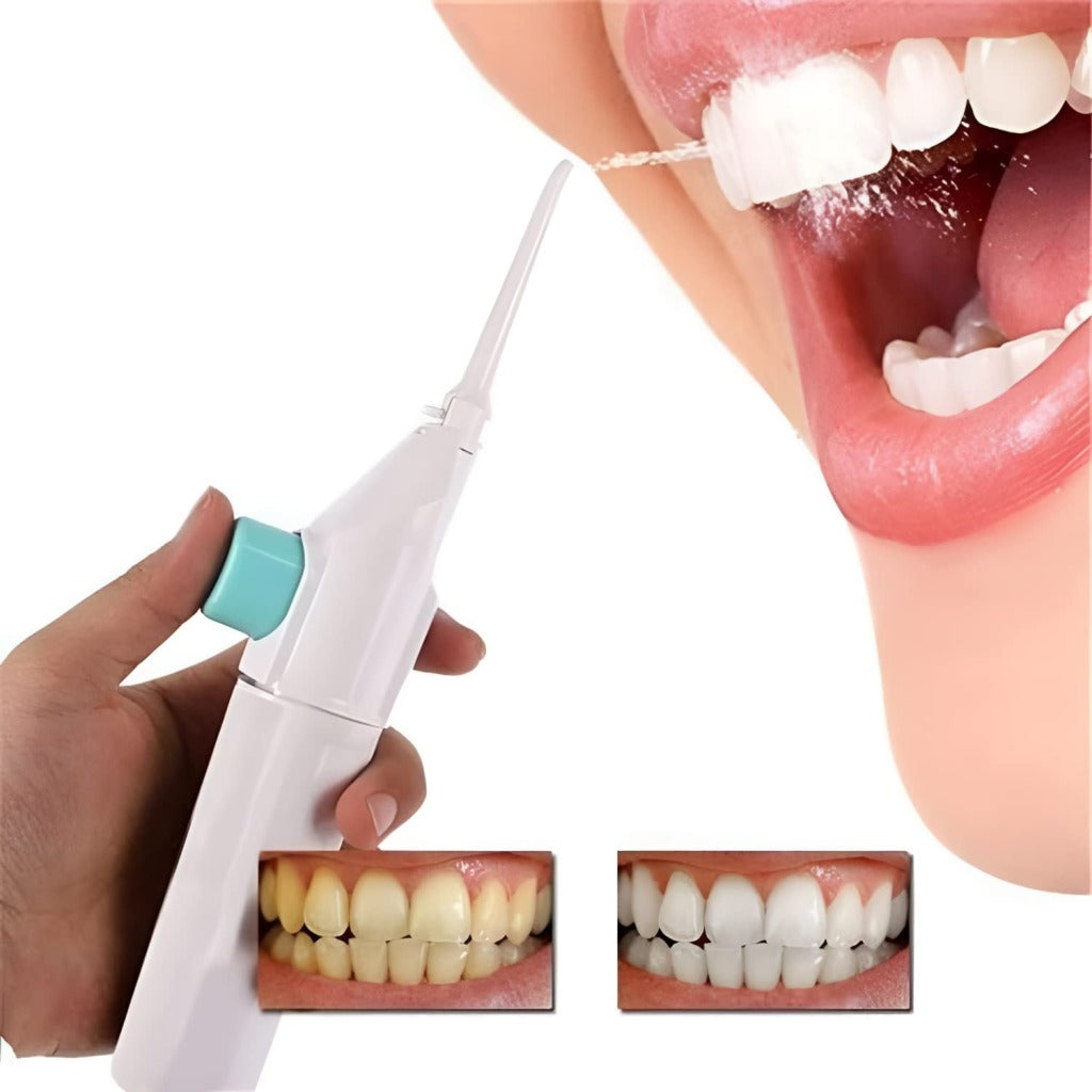 Portable Dental Water Flosser β Cordless Air Pressure Oral Irrigator for Teeth Cleaning | Manual Water Jet Tooth Cleaner for Travel & Daily Dental Care (White)