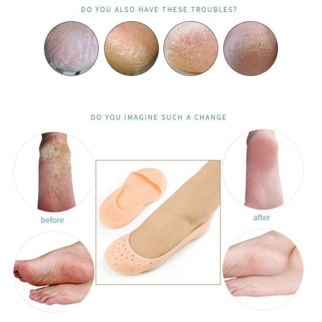 Anti Crack Full Length Silicone Foot Protector Moisturizing Socks for Foot-Care and Heel Cracks, socks for cracked feet, heel pad for heel pain, anti crack heel socks (Full Heel)