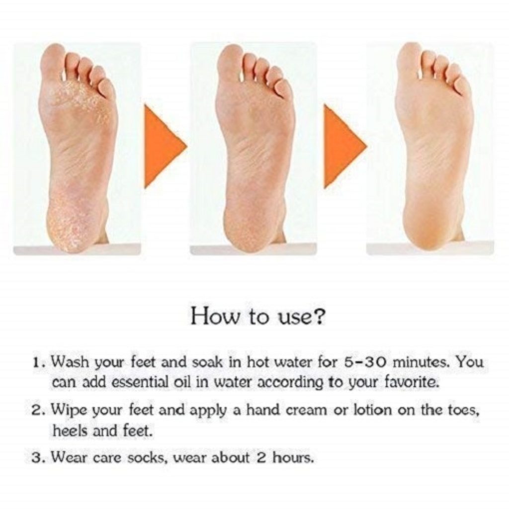 Anti Crack Full Length Silicone Foot Protector Moisturizing Socks for Foot-Care and Heel Cracks, socks for cracked feet, heel pad for heel pain, anti crack heel socks (Full Heel)